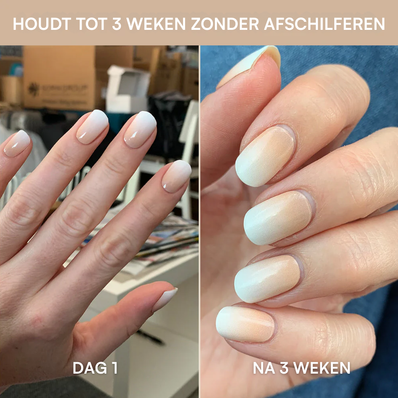 Nagelkit Starterset