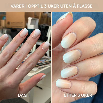 Nagelkit Starterset